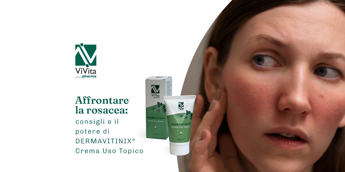 Rosacea