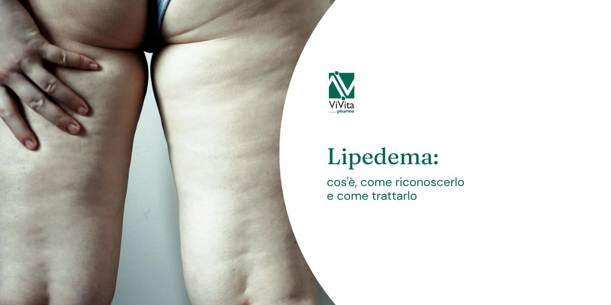 Lipedema